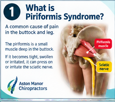piriformis_poster_01